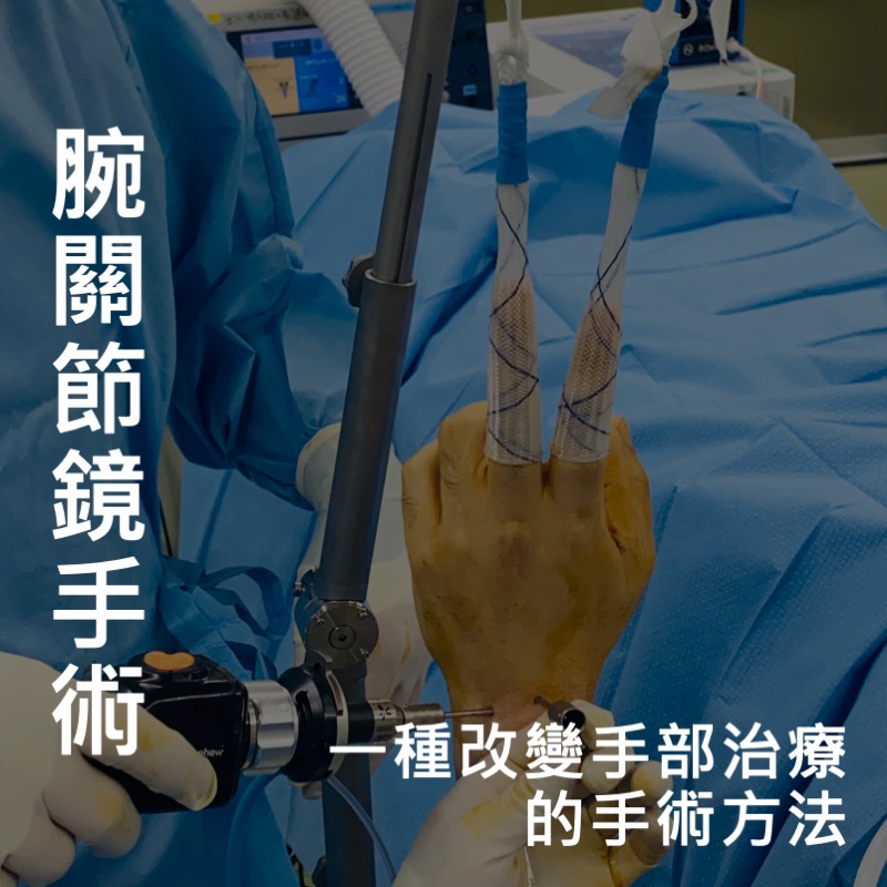 腕節鏡手術