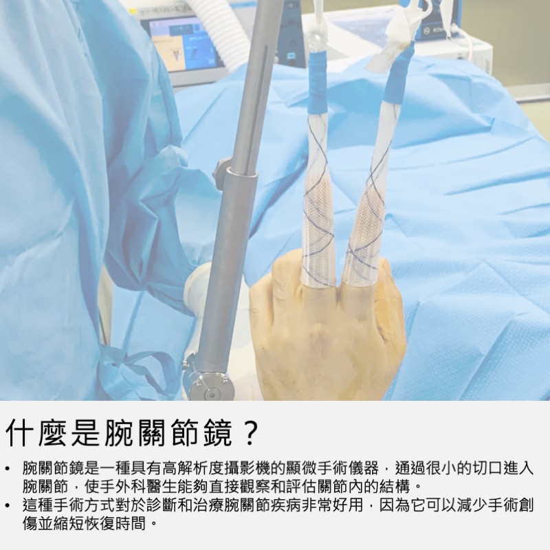 腕節鏡手術介紹