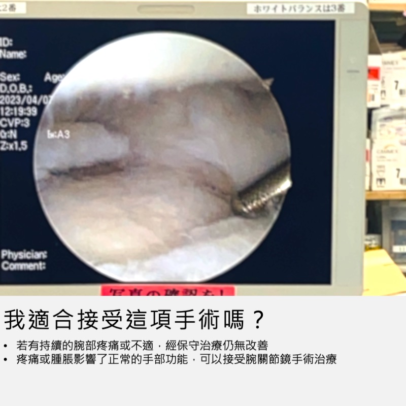 腕節鏡手術適合對象