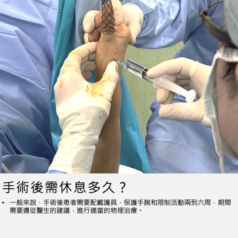 腕節鏡手術術後恢復