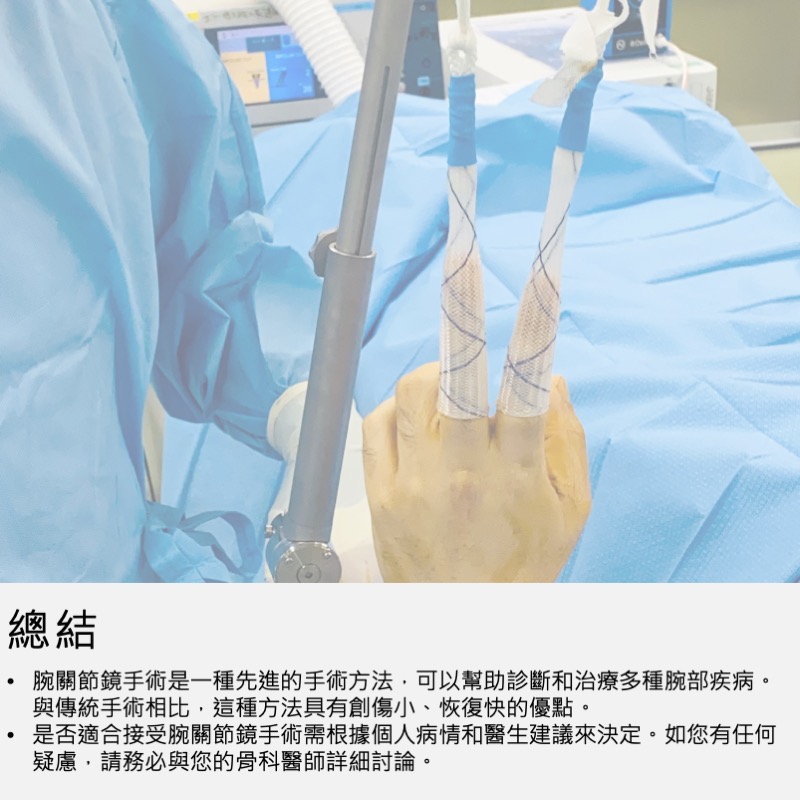 腕節鏡手術總結介紹